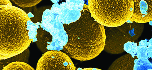 Scanning micrograph of staph aureus and white blood cells.